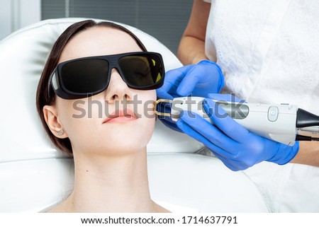 Skin Care. Young Woman Receiving Facial Beauty Treatment, Removing Pigmentation At Cosmetic Clinic. Intense Pulsed Light Therapy. IPL. Rejuvenation, Photo Facial Therapy. Anti-aging Procedures. Laser Royalty-Free Stock Photo #1714637791