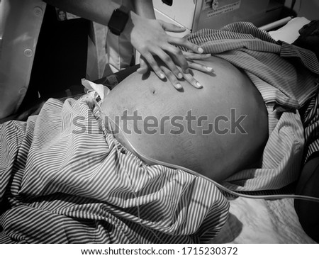  Doctor performing fluid thrill test to confirm Ascites in patient with Liver Disease. Royalty-Free Stock Photo #1715230372