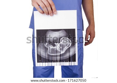 Doctor holding a baby picture of the fetus.