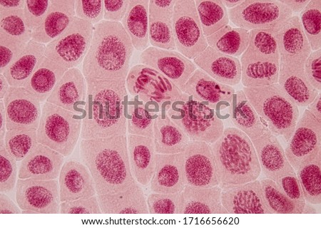 Root tip of Onion and Mitosis cell in the Root tip of Onion under a microscope.
 Royalty-Free Stock Photo #1716656620