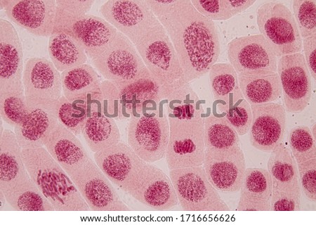 Root tip of Onion and Mitosis cell in the Root tip of Onion under a microscope.
 Royalty-Free Stock Photo #1716656626