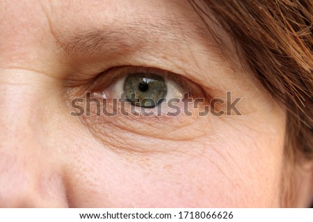 green eye with brown spots on the face of an elderly woman, small wrinkles on the eyelids, overhang, the concept of age-related changes in human skin Royalty-Free Stock Photo #1718066626