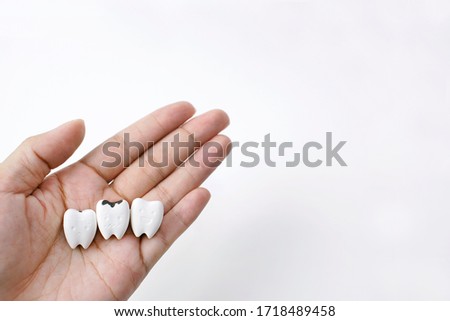 Healthy Tooth and Decayed Tooth on Hand on White Background, Copy Space                                