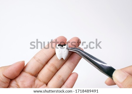 Decayed tooth pinching by clamp on hand on white background, Signs of tooth decay and cavity, see your dentist as soon as possible.
