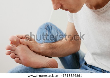 Medical shot of a man at home  checking his wart on the toe. Royalty-Free Stock Photo #1718524861