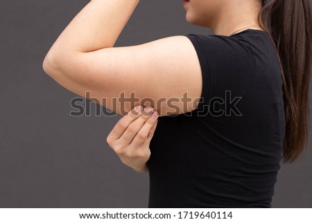 Bingo wings, female arm with loose skin. Royalty-Free Stock Photo #1719640114