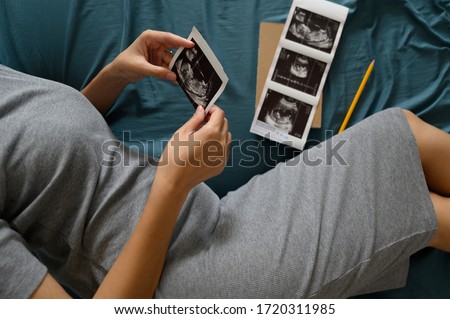 High angle shot of a pregnant woman lie down looking at a sonogram ultrasonography picture of her unborn baby in her bedroom at home