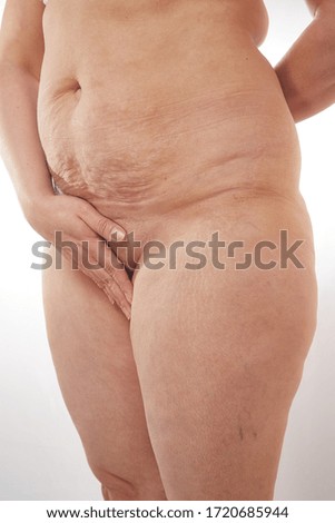 legs and belly of a 40-year-old woman with stretch marks, cellulite and excess weight on a white isolated background