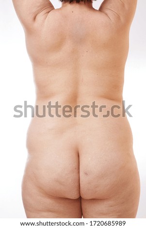 legs, buttocks and back of a 40-year-old woman with stretch marks, cellulite and excess weight on a white isolated background