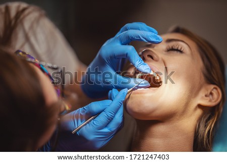 The beautiful young woman is at the dentist. She sits in the dentist's chair and the dentist sets braces on her teeth putting aesthetic self-aligning lingual locks. Royalty-Free Stock Photo #1721247403