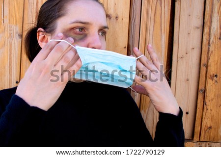 A woman is trying to hide traces of domestic violence by wearing a medical mask. The concept of rising domestic violence during quarantine isolation COVID-19. Royalty-Free Stock Photo #1722790129