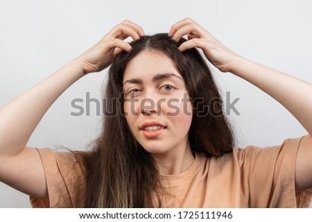 Dandruff and lice. Portrait of a young Caucasian woman, a brunette, who strongly scratches her head with her hands. White background