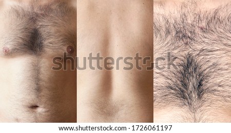 Hairy body of a man, stomach and chest, excessive hairiness, depilation, moles, overweight navel.