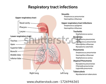 Human respiratory system with description of the corresponding parts. Respiratory tract infections of upper and lower respiratory tracts. Anatomical vector illustration in flat style.  Royalty-Free Stock Photo #1726946365