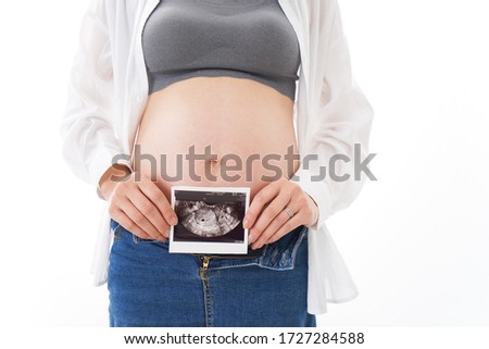 Young pregnant woman with echo image