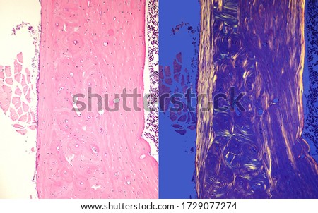 Comparative micrographs of cortical compact bone stained with HE (left) and seen under polarized light (right), which highlight the outer and inner circumferential lamellae and osteons Royalty-Free Stock Photo #1729077274
