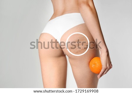 Young woman with orange on light background. Problem of cellulite Royalty-Free Stock Photo #1729169908