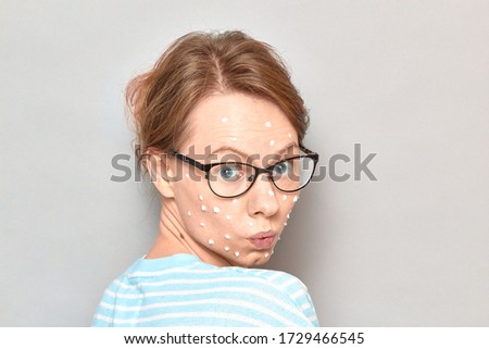 Close-up portrait of surprised amazed girl with glasses, with white drops of face cream on skin, over gray background. Care for imperfect, problem, acne prone skin. Skincare and beauty concept