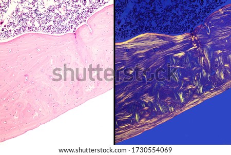 Comparative micrographs of cortical compact bone stained with HE (left) and seen under polarized light (right), which highlight the outer and inner circumferential lamellae and osteons Royalty-Free Stock Photo #1730554069