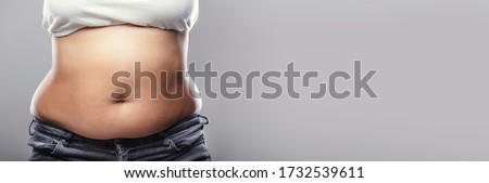 Belly Fat And Weight Lose. Overweight Woman Stomach Royalty-Free Stock Photo #1732539611