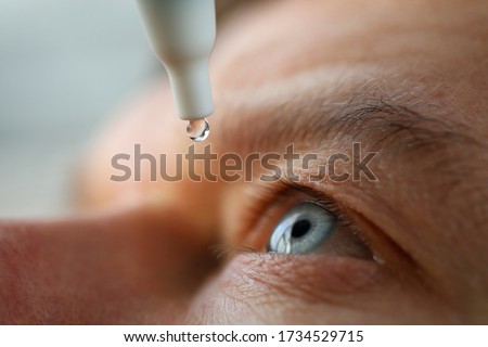 Man drops eye drops install lenses, moisturizing. Preservation and solution vision problems. Eye diseases are recognized. Drops before putting on lenses or before removing at end day Royalty-Free Stock Photo #1734529715
