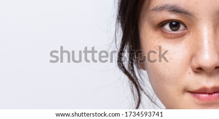 Close up half fresh face of Asian women is looking at camera on white banner background with copy space, Problem skin face, Freckle on face of Asian women,  Royalty-Free Stock Photo #1734593741