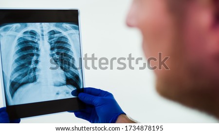 X-ray of the lungs in the hands of a doctor.Doctor looking at an x-ray in the surgical room.Diagnose pneumonia,pulmonary edema in a photo picture.Study x-ray.