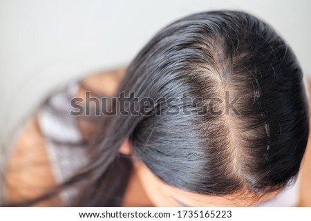 Woman with problem thin hair. Royalty-Free Stock Photo #1735165223