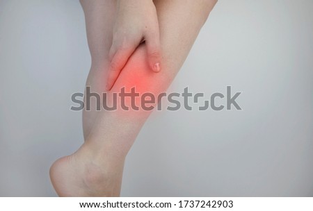 A woman suffers from pain in the calves. Stretching the calf muscle, varicose veins, leg cramps, or myositis. Orthopedic doctor examines patient Royalty-Free Stock Photo #1737242903