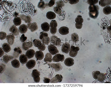 Protoscolices Echinococcus multilocularis microscopic photo of being released from a larvacyst. Is a cyclophyllid tapeworm, produces the fatal disease alveolar echinococcosis in mammals