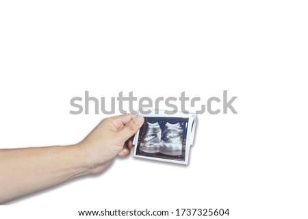 The doctor holding  a sheet of ultrasound examination for the patient in room.on white background,Medical image concept,Selective focus.