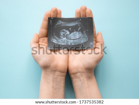 pregnancy ultrasound in the palms on the background. hands holding a picture of ultrasound of pregnancy