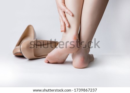 Callus blisters on woman feet. Painful wounds. Uncomfortable shoes problems. Women after a workday on high heels Royalty-Free Stock Photo #1739867237