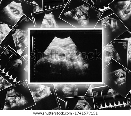 ultrasound picture of a child baby