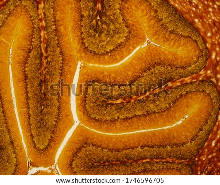 Low magnification micrograph of a silver stained cerebellum. Each folium shows the three layers of cerebellar cortex (molecular, Purkinje and granular) surrounding a central axis of white matter. Royalty-Free Stock Photo #1746596705
