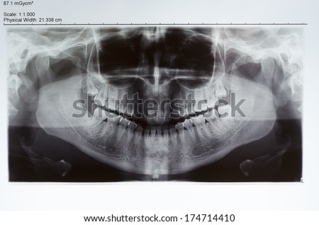 Picture of a dental x-ray