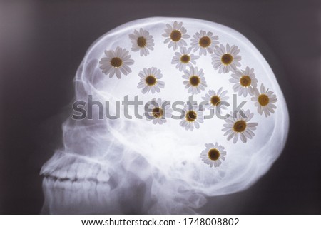 X-ray of the bones of the skull, with white daisies filled in the picture. Medical concept. Flowers and x-ray of the skull. Flowers in the head, with a background on ideas