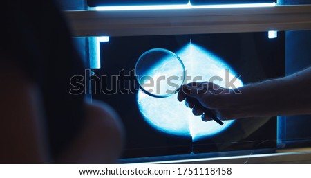 Doctor examines mammogram snapshot of breast of female patient on the monitors with magnifying glass . Breast cancer prevention.