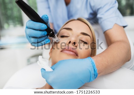 Microneedle mesotherapy. Beautiful blond woman receiving microneedling rejuvenation treatment.  Royalty-Free Stock Photo #1751226533