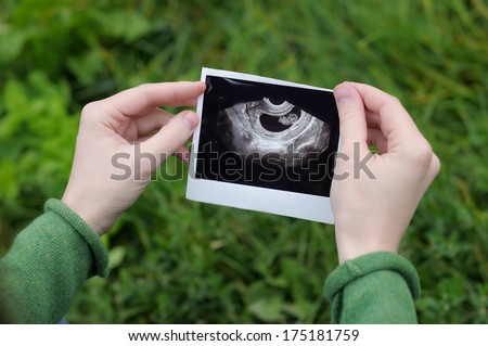 Woman holding ultrasound photographs of pregnancy 