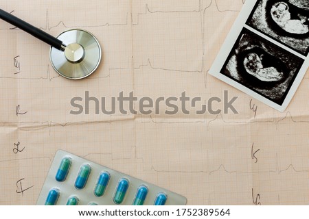 on the table of a gynecologist a medical stethoscope and embryo picture, pills in a blister, cardiogram background