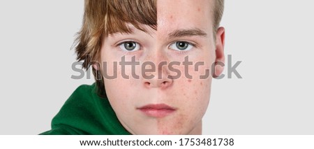Serious Boy merge to teen headshot half side by side growth and development Royalty-Free Stock Photo #1753481738