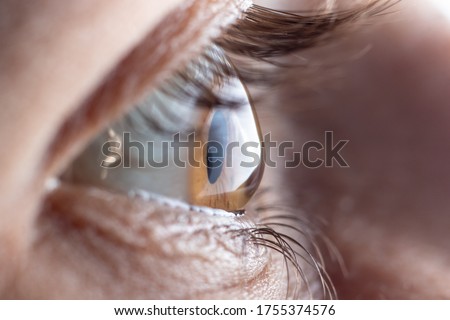 Macro picture of the eye. The cornea in the form of a cone, the disease of the eye keratoconus. Astigmatism. Royalty-Free Stock Photo #1755374576