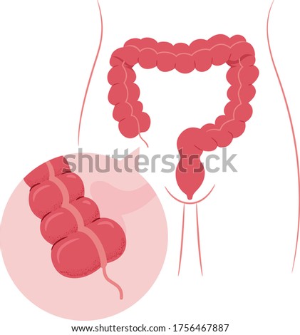 Illustration of a Large Intestine Body Organ With Magnified Appendix
