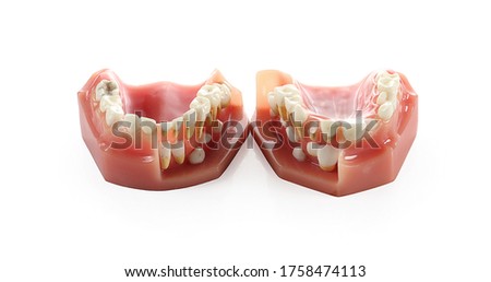 Tooth model isolated on a white background, photography 