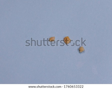 Tonsil stone (tonsillolith) on a piece of paper