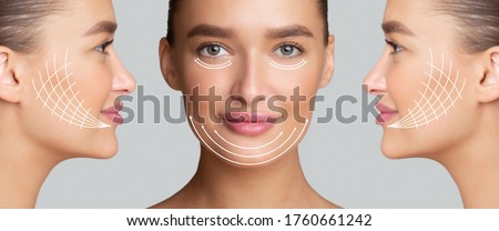 Cosmetology Concept. Collage of side and front view portrait of woman with arrows on face for lifting skin, panorama Royalty-Free Stock Photo #1760661242