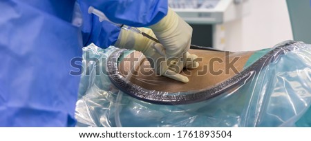 Surgeon in blue surgical gown uniform doing lumbar puncture before insert epidural catheter under fluoroscope inside modern operating room. Epidural steroid injection use for spinal stenosis patient.