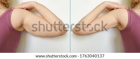 female hand   after losing weight Royalty-Free Stock Photo #1763040137