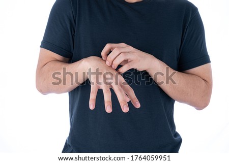 Male scratching his hand on isolated white background. Medical, healthcare for advertising concept.